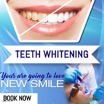 teeth-whitening-small.jpg