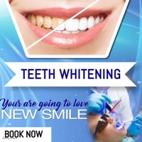 teeth-whitening200.jpg