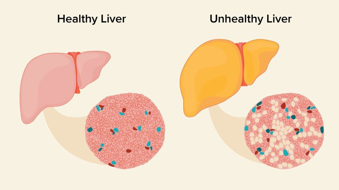 Liver.jpg