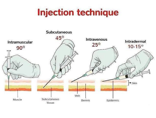 Types-of-injection.jpg